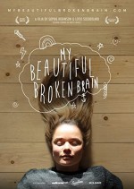 My Beautiful Broken Brain (2014) afişi
