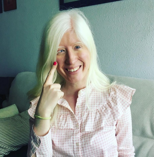 Patty Bonet Fotoğrafı