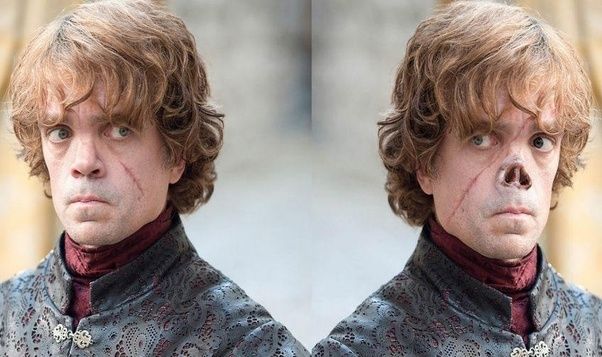 Tyrion aslında burunsuz kalmalıydı! Tyrion aslında burunsuz kalmalıydı!