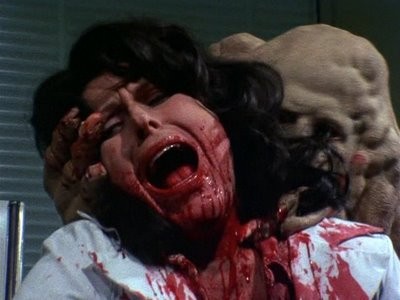 Basket Case Fotoğrafı