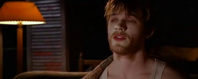 Biri Beni Isırdı Fotoğrafı