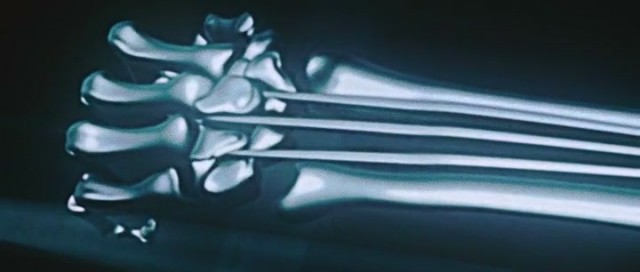 X-Men Başlangıç: Wolverine Fotoğrafı