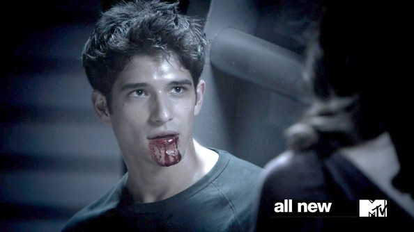 Teen Wolf Fotoğrafları 275