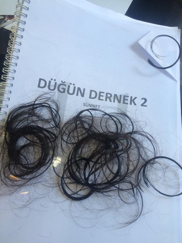 Düğün Dernek 2: Sünnet Fotoğrafı