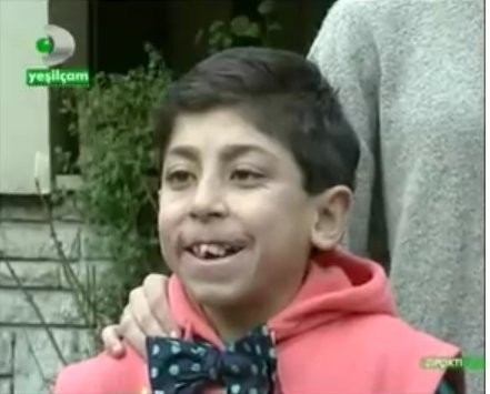 Zıpçıktı Fotoğrafı